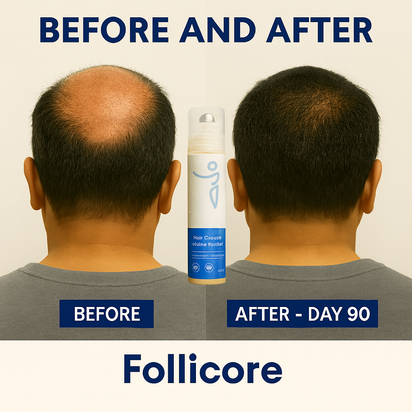Follicore Hair Growth Roll™